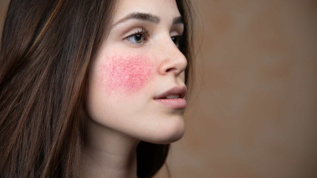 The most common skin conditions, and their cures