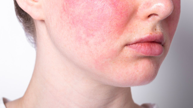 Sensitive skin: causes, care, and when to seek help