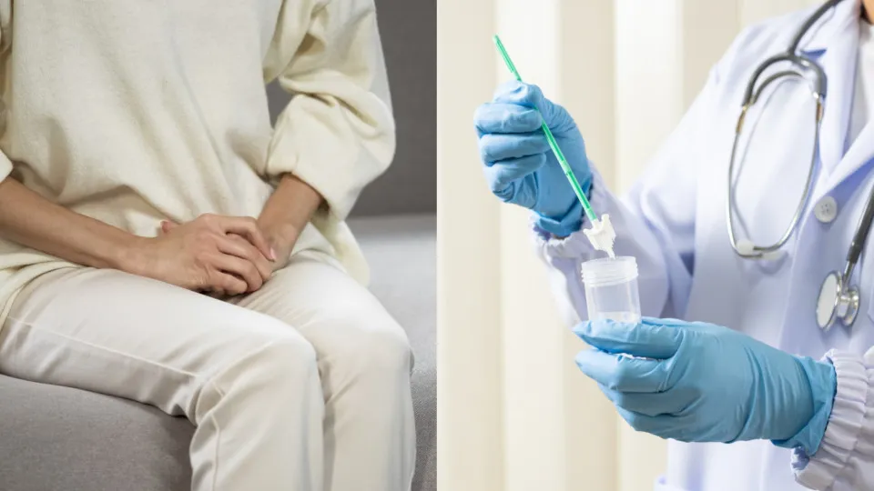 Women can now test for cervical cancer virus at home