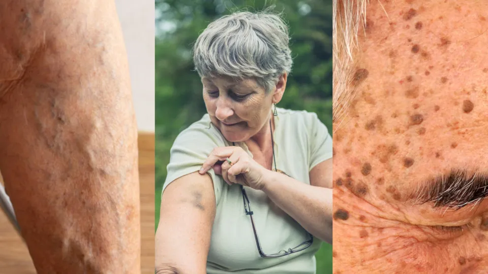 Vieillissement cutané : les modifications qui devraient vous inquiéter