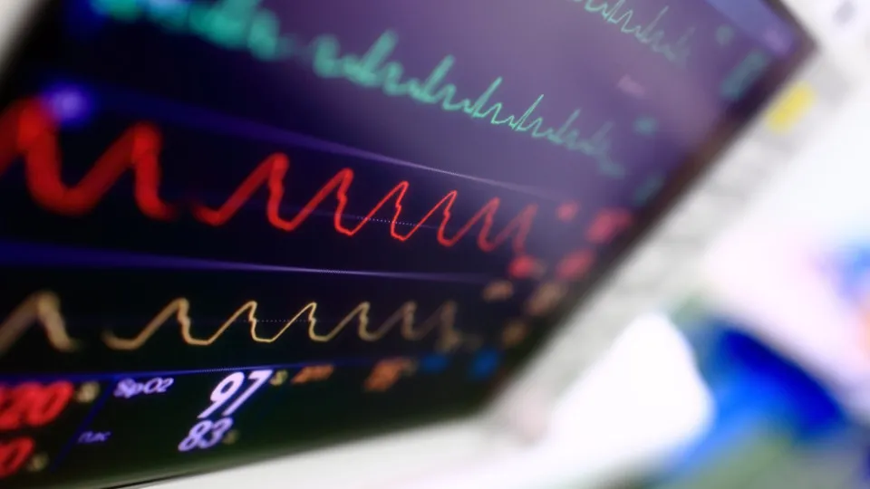 Heart issues that might signal dementia