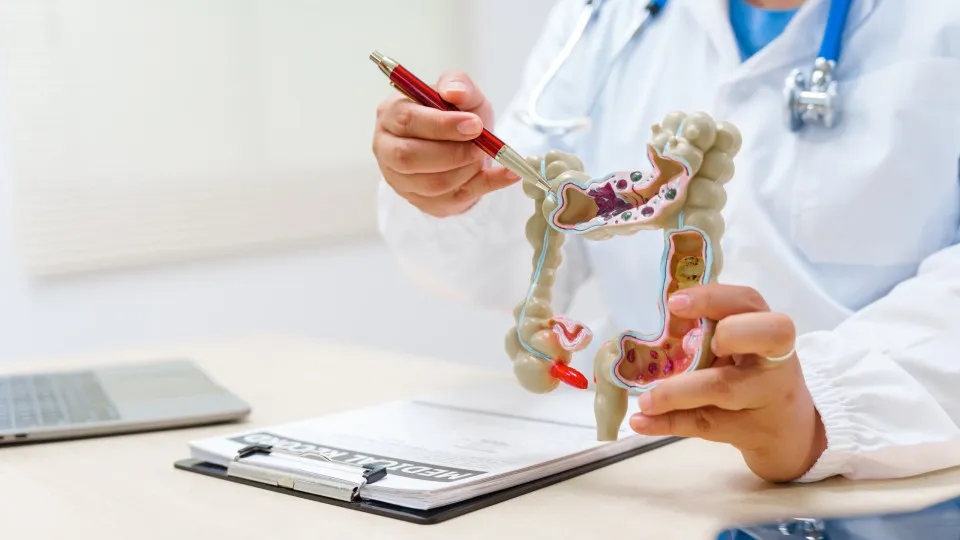 Sua dieta pode afetar o risco de câncer de intestino?