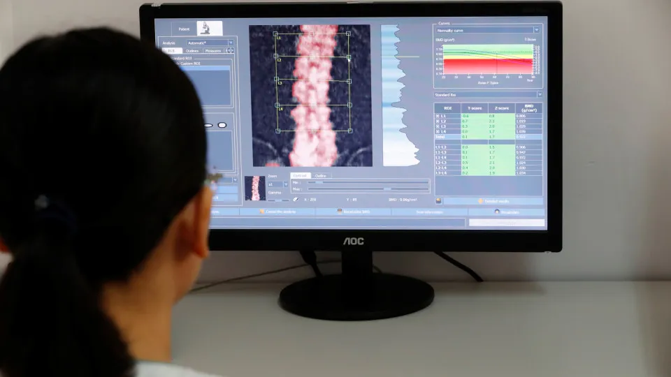 Osteoporosis: the silent disease