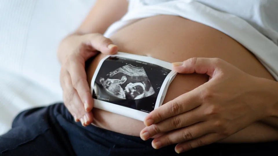 Countries where babies receive their mother's surname