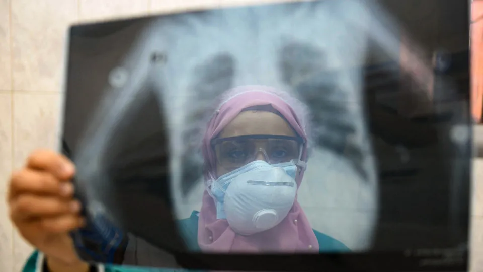 Everything you need to know about lung cancer