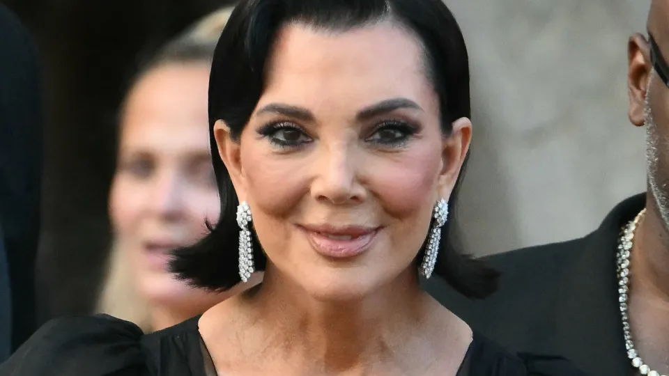 Celebrities who have had plastic surgery