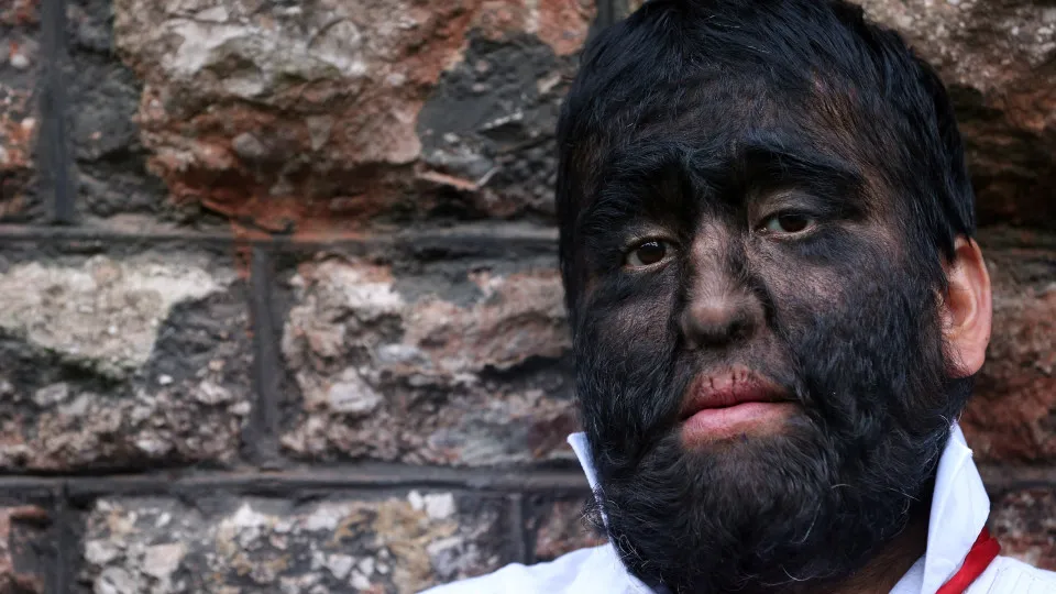 Rare medical conditions that sound made-up but are real