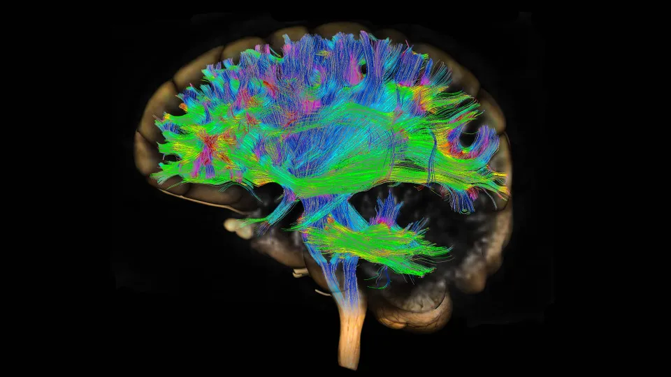 Il litio potrebbe curare il morbo di Alzheimer?