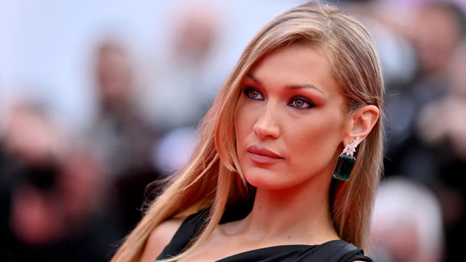 Celebrities who have had plastic surgery