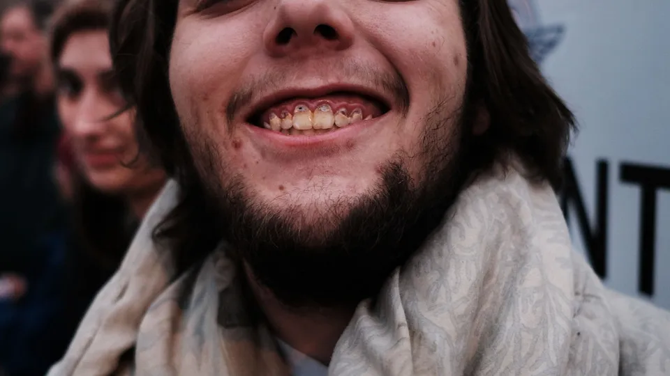 Die Folgen, wenn man nicht mehr die Zähne putzt