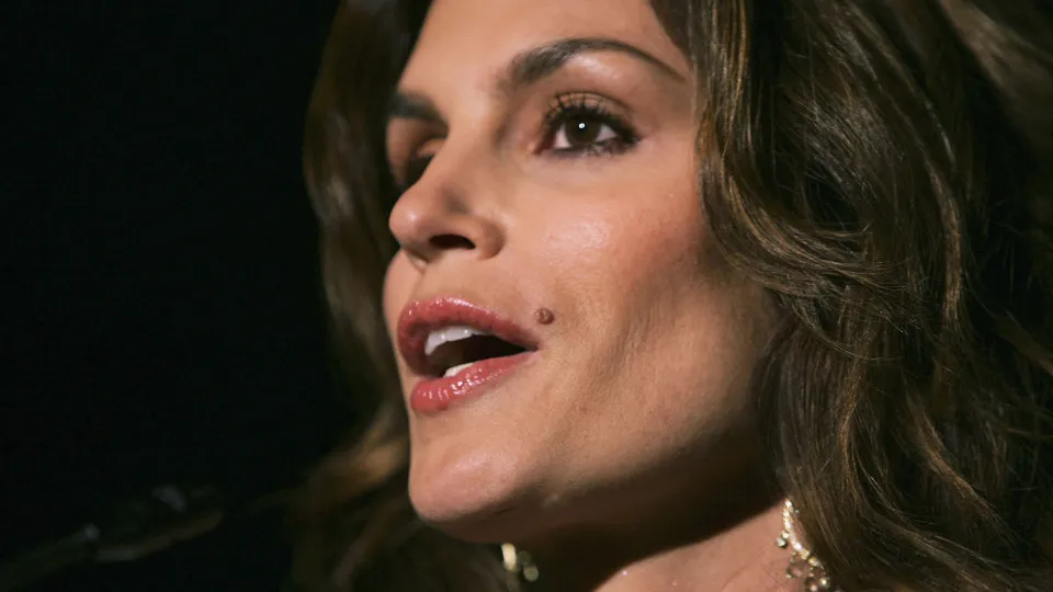 Birthmarks and the celebrities who embrace theirs