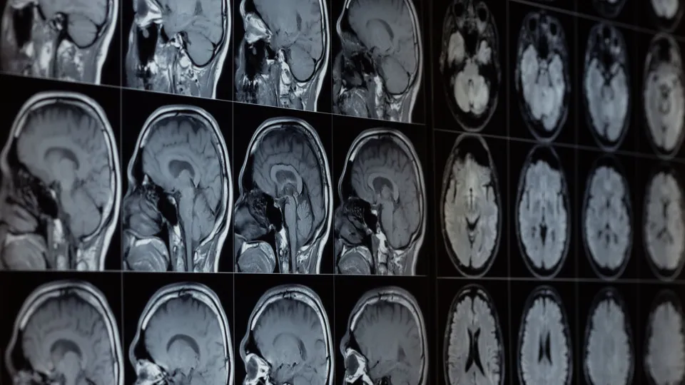 The rarest causes of death in the world