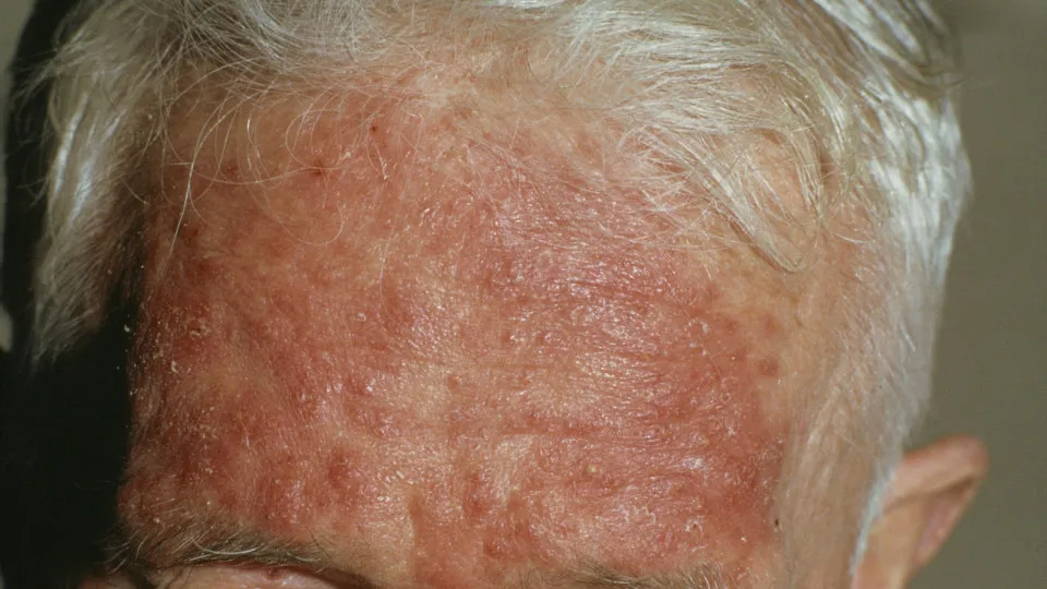 The most common skin conditions, and their cures