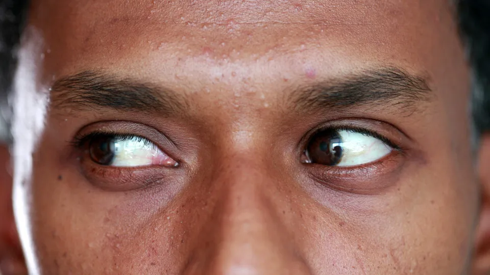 Los mejores trucos para disimular las ojeras