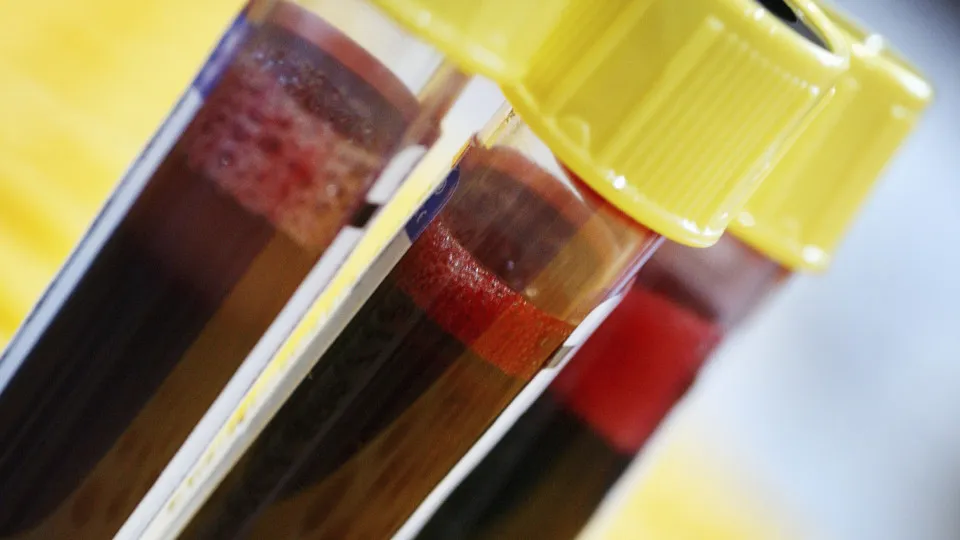 血液型は個性を決定づけるのか？