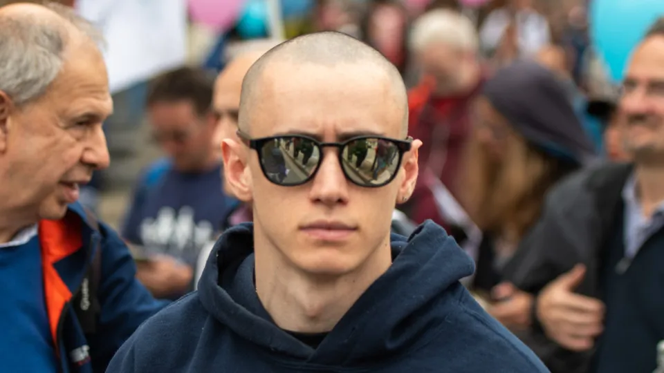 Here's why millennials are losing their hair